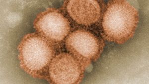 Drei Viertel der Influenzafälle sind Schweinegrippe